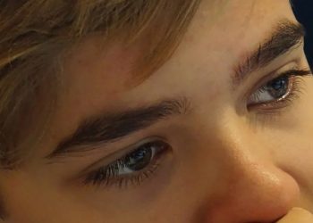 Kenali Gejala Epilepsi pada Anak