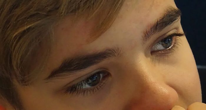 Kenali Gejala Epilepsi pada Anak