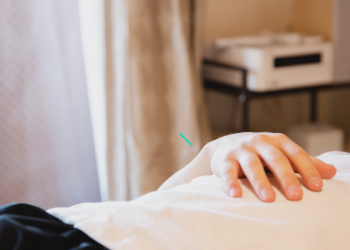 Akupunktur agar Wajah Lebih Muda