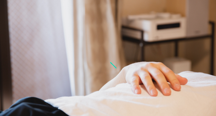 Akupunktur agar Wajah Lebih Muda