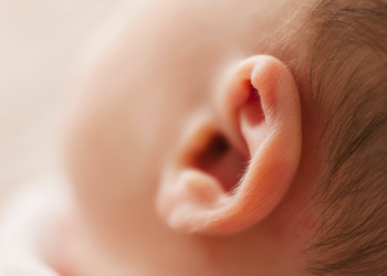 Akupunktur agar Wajah Lebih Muda