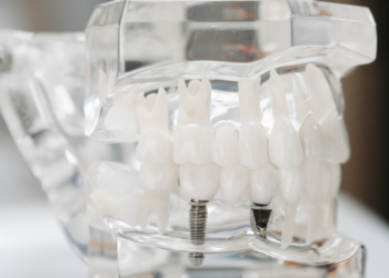 Gigi Tonggos, Perlukah Dicabut?