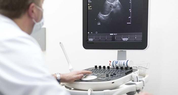 Tes Darah dan USG Rutin dapat Tekan Resiko Kanker Ovarium