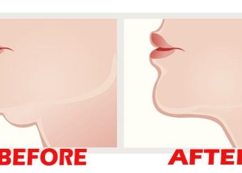 Hilangkan Lemak di Dagu dengan Trik Mudah Ini