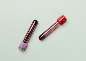 Resep Roti Panggang Sosis, Bekal Keren untuk si Kecil