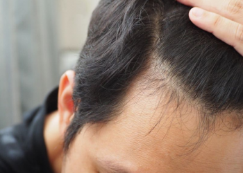 8 Tahapan Mengatur Kemarahan pada Istri agar Tak Berujung KDRT