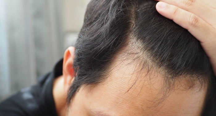 8 Tahapan Mengatur Kemarahan pada Istri agar Tak Berujung KDRT
