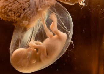 Mengenali Kondisi Air Ketuban yang Tidak Normal