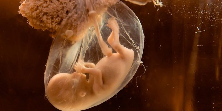 Mengenali Kondisi Air Ketuban yang Tidak Normal