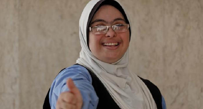 penyandang down syndrome