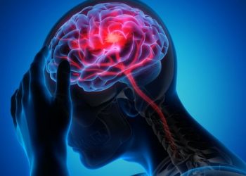 Serangan Pertama Stroke Intai Kaum Muda