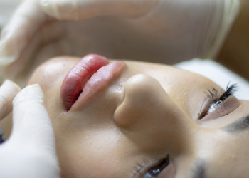 Hukum Terapi Botox bagi Pasien dan Dokter Kecantikan