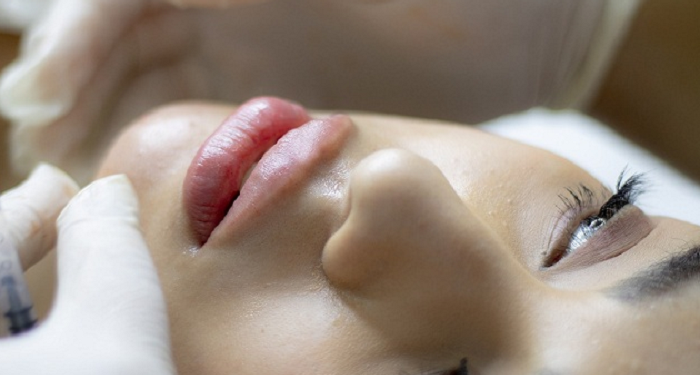 Hukum Terapi Botox bagi Pasien dan Dokter Kecantikan