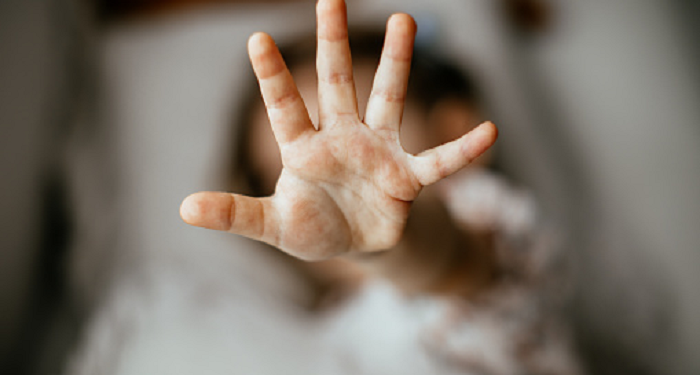 Ayah Bunda, Kenali Faktor Terjadinya Kekerasan pada Anak