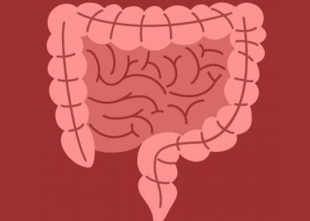 Penyakit kanker usus