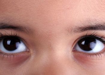 Macam-macam gangguan mata pada balita