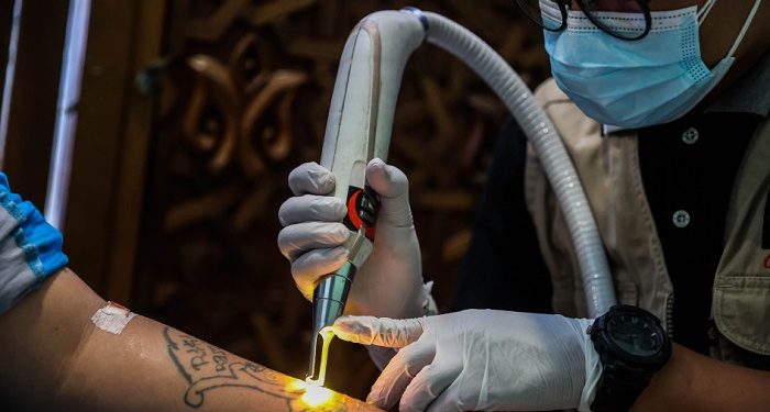 IMS-YBM PLN Gelar Hapus Tato Gratis di Nusakambangan