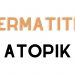 Dermatitis atopik