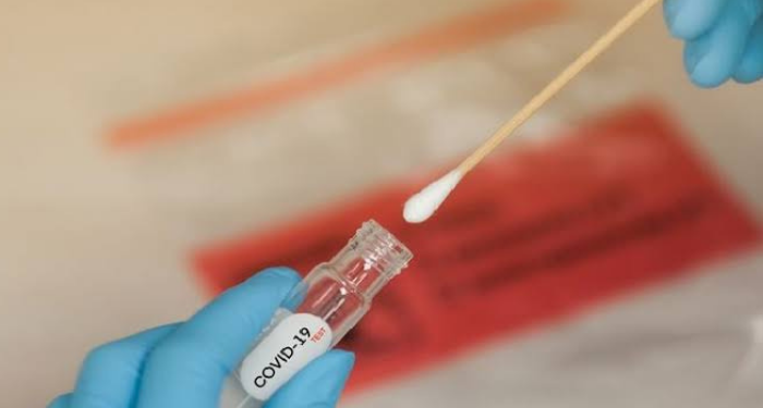 Hukum Tes Swab saat Puasa versi MUI