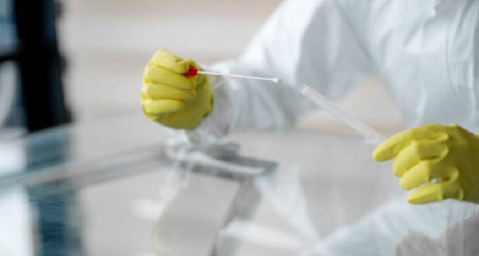 5 Hal yang Harus Diketahui Soal Rapid Test Antigen