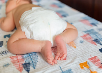 Mengatasi Ruam Akibat Penggunaan Popok