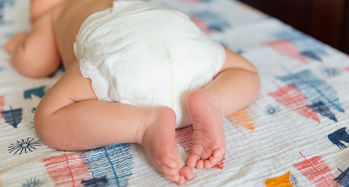 4 Cara Mencegah Ruam Popok Bayi Dengan Kulit Sensitif_womanindonesia.co.id