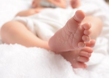 Hukum Menghilangkan Tanda Lahir