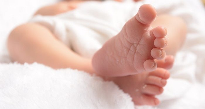 Hukum Menghilangkan Tanda Lahir