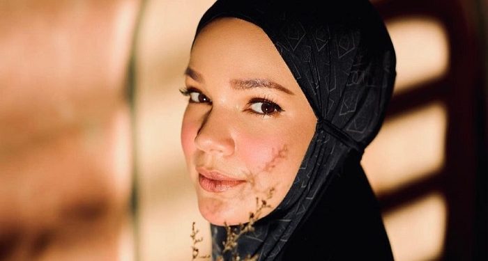 Cerita Dewi Sandra Bandingkan Rasa Sakit Dibius dengan Rendahnya Iman