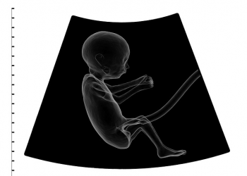 Perkembangan Janin Trimester Ke Tiga