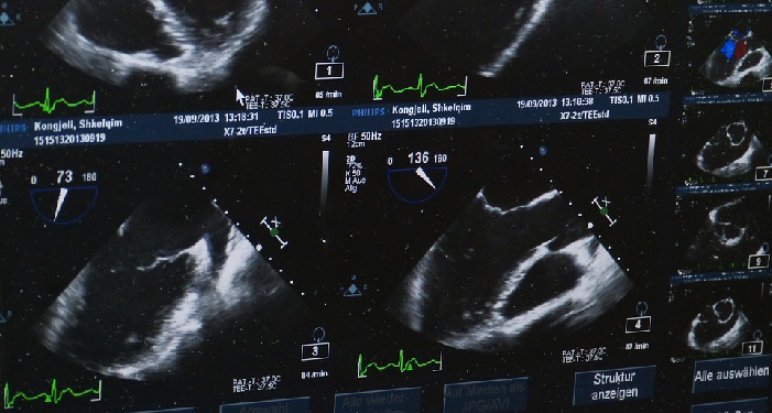 Manfaat Melakukan USG Pada Ibu Hamil