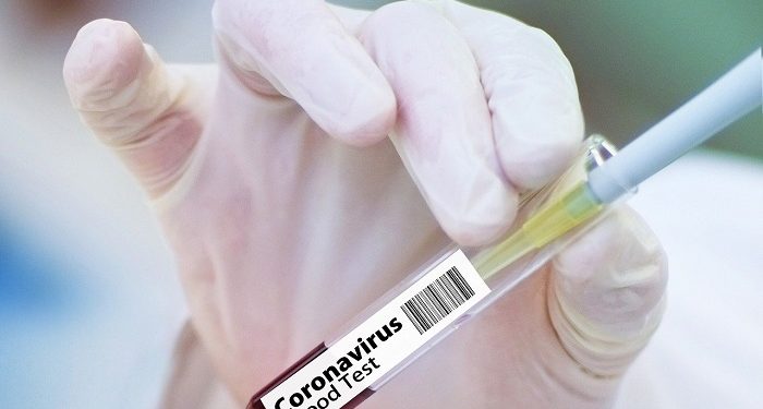 Guru Wajib Vaksin Tapi Murid Tidak