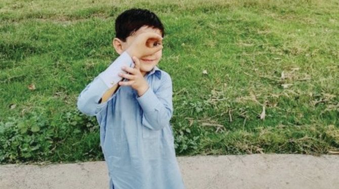 Bocah 4 Tahun Pakistan Buat Sejarah Ssebagai Orang Termuda dengan Lengan Bionik