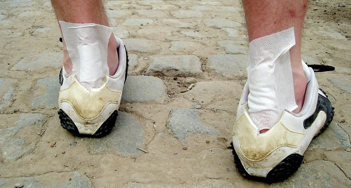 85 Persen Luka Diabetes Dapat Dicegah