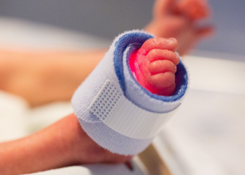 Merawat Bayi Prematur