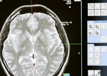 Manfaat Lantunan Azan dan Al-Qur’an untuk Otak