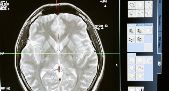 Manfaat Lantunan Azan dan Al-Qur’an untuk Otak