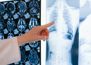 Cara Memeriksa Kesehatan Paru-paru