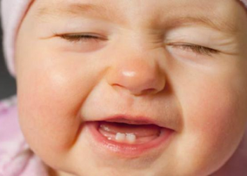 Gigi Bayi Telat Tumbuh, Jangan Panik Dulu, Cek Sebabnya Berikut Ini