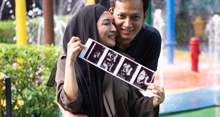 Barakallah, Fedi Nuril dan Istri Dikarunia Anak Ketiga