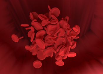 Waspada Gejala Thalassemia Pada Anak