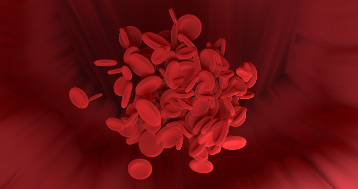 Waspada Gejala Thalassemia Pada Anak