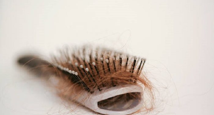 Kenali Jenis-Jenis Rambut Rontok Sebelum Alami Kebotakan