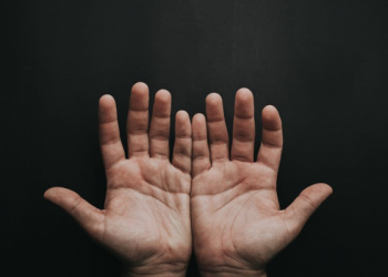 Upaya atasi Penyakit Kusta pada Anak