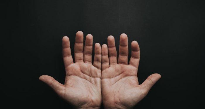 Upaya atasi Penyakit Kusta pada Anak