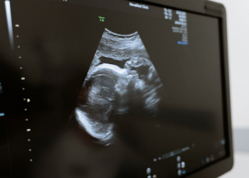 USG Portable Disiapkan untuk Tekan Angka Kematian Ibu