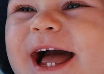 Jadwal Ideal Bayi Tumbuh Gigi