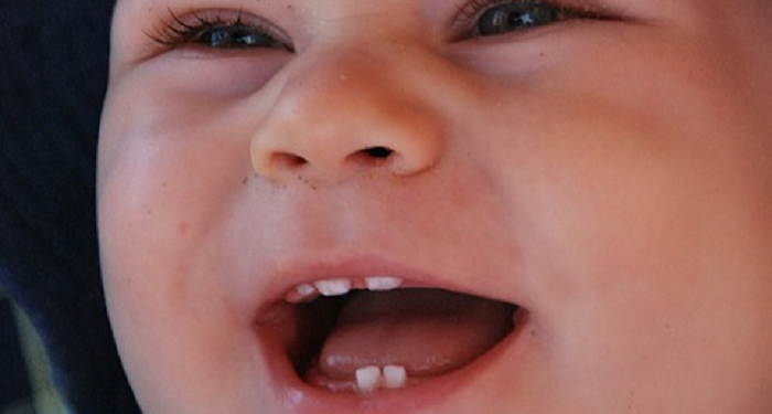 Jadwal Ideal Bayi Tumbuh Gigi