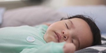 Kenali Epstein Pearls, Benjolan Putih Kecil Pada Bayi