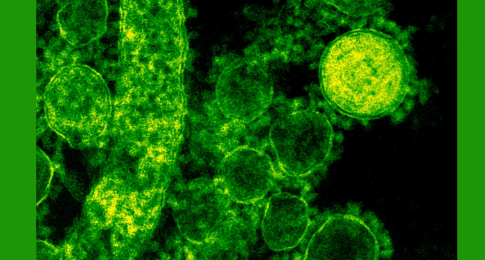 Ketika Wabah Penyakit Terjadi pada Masa Abbasiyah